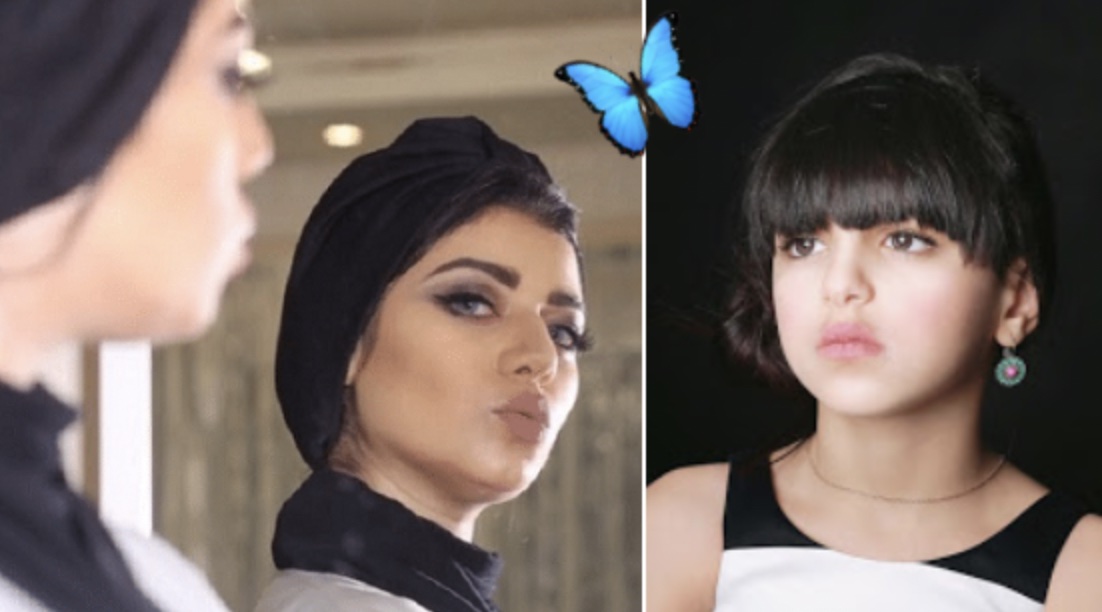 Naglaa Abd Al Aziz before and after