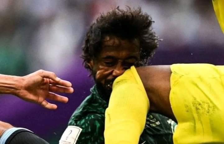 محمد العويس يؤذي الشهراني يظهر في الصورة لاعب وهو يتعرض لإصابة في الأنف